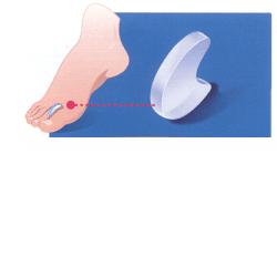 PODOGEL DIVARICATORE MISURA SMALL - Farmastop