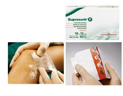 MEDICAZIONE STERILE IN FILM IN POLIURETANO TRASP. SUPRASORB F 10X12CM 10 PEZZI - Farmastop